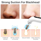 Upgraded Blackhead Remover Pore Vacuum